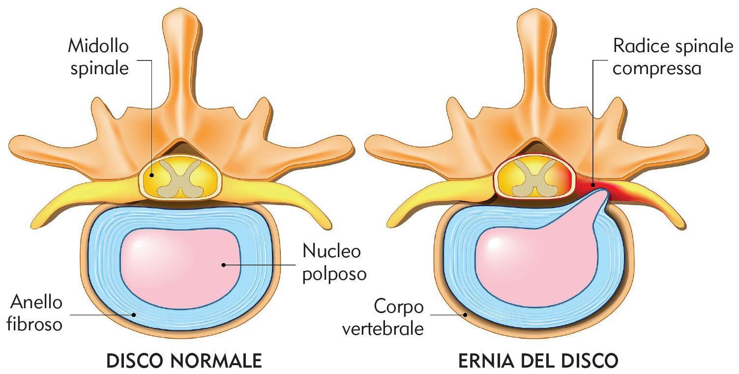 Chiropratica Diquigiovanni